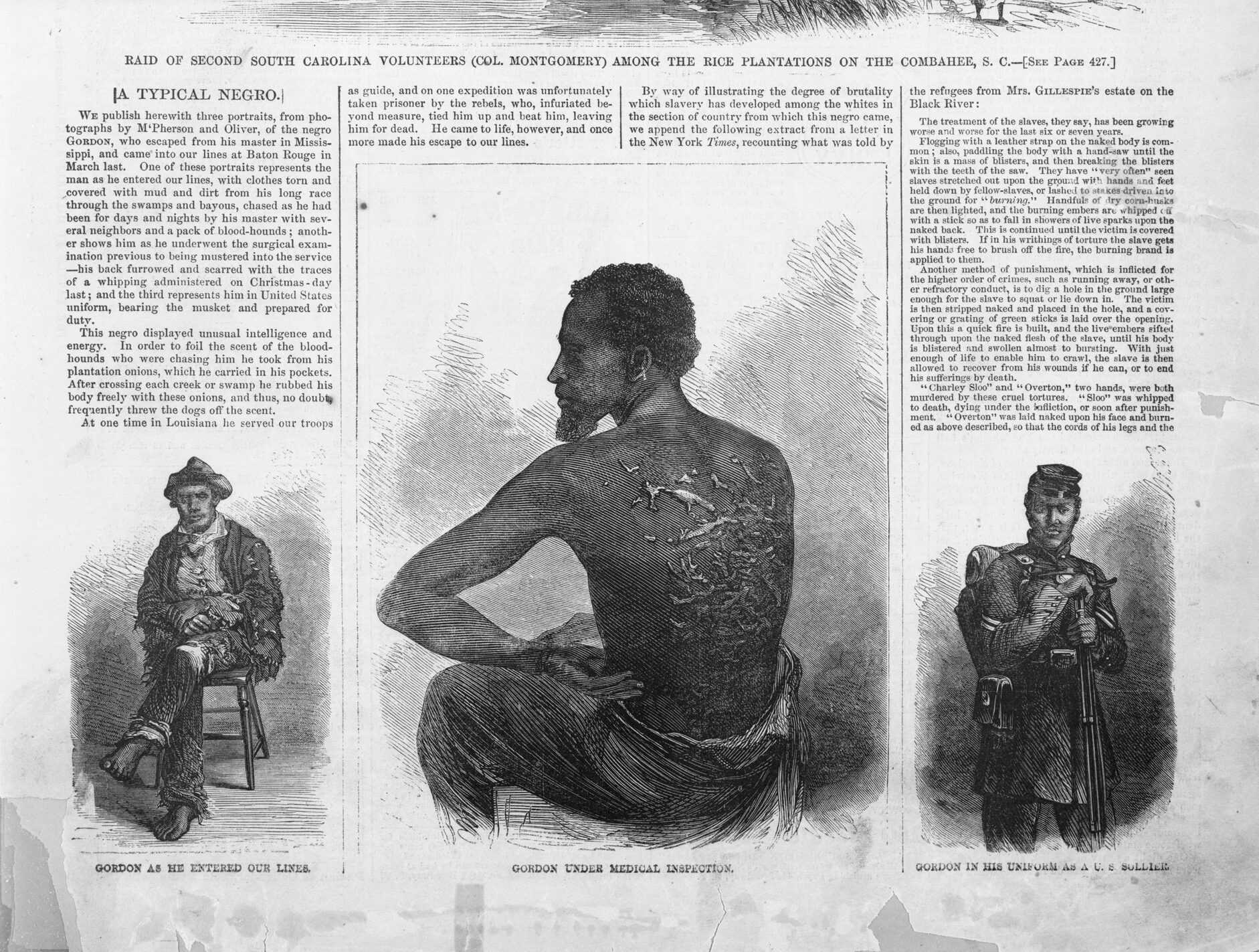 Image of 3 illustrations of  Private Gordon as he entered the union army, his back during medical inspection and in army uniform.