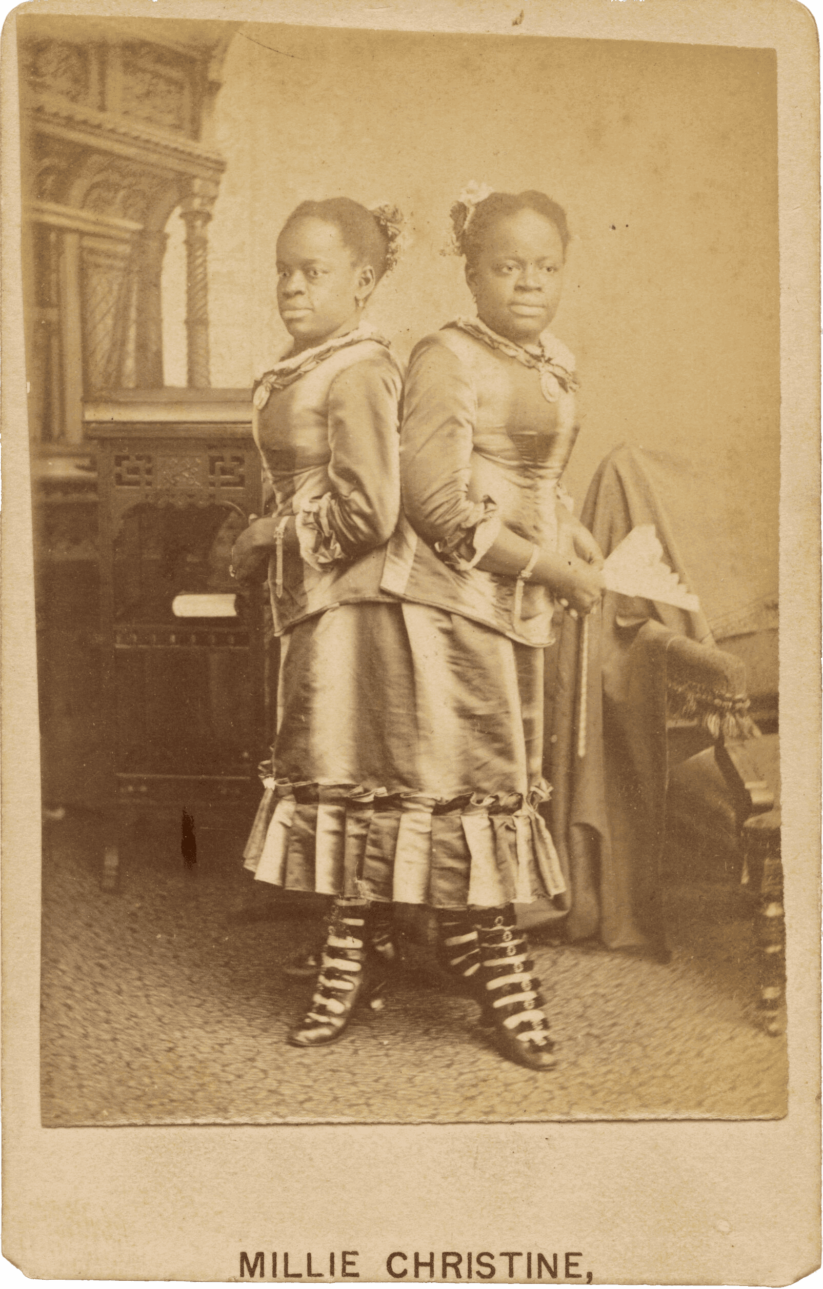 Images of a carte-de-visite photograph of conjoined twins Millie and Christine McCoy.