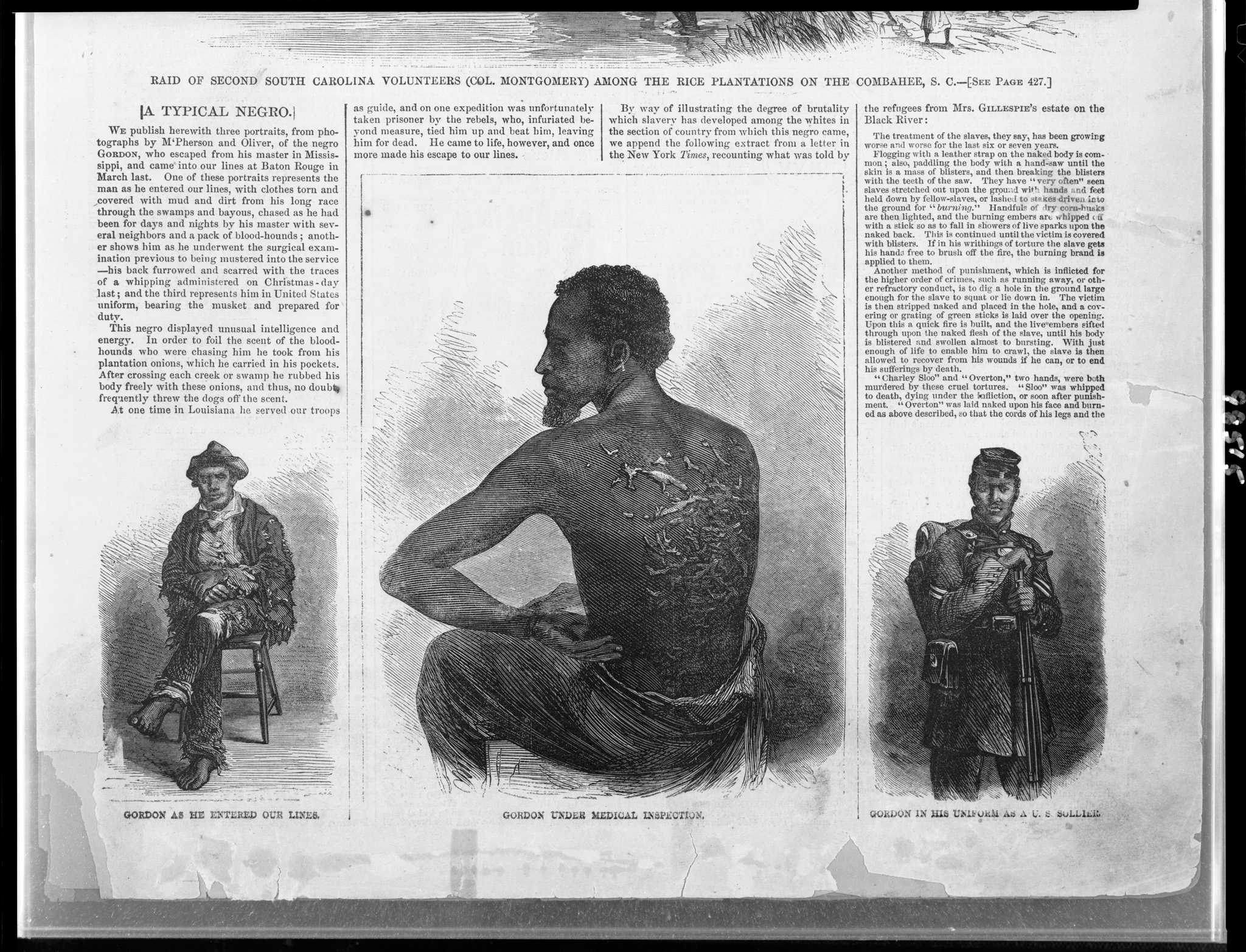 Image of 3 illustrations of  Private Gordon as he entered the union army, his back during medical inspection and in army uniform.
